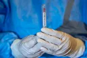 OBSh-ja: Rastet me hantavirus mbeten në 13, nuk janë raportuar vdekje të reja mbi një muaj