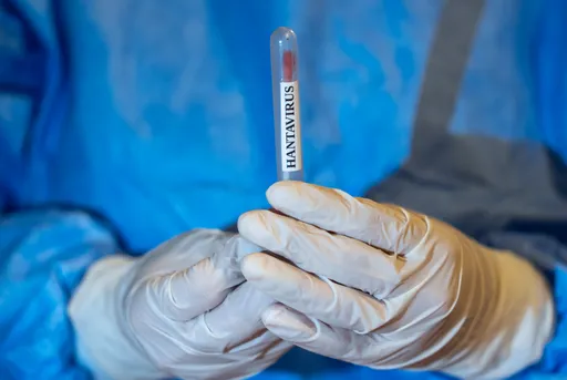 OBSh-ja: Rastet me hantavirus mbeten në 13, nuk janë raportuar vdekje të reja mbi një muaj
