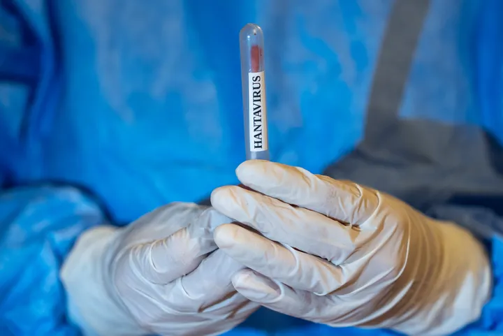 OBSh-ja: Rastet me hantavirus mbeten në 13, nuk janë raportuar vdekje të reja mbi një muaj