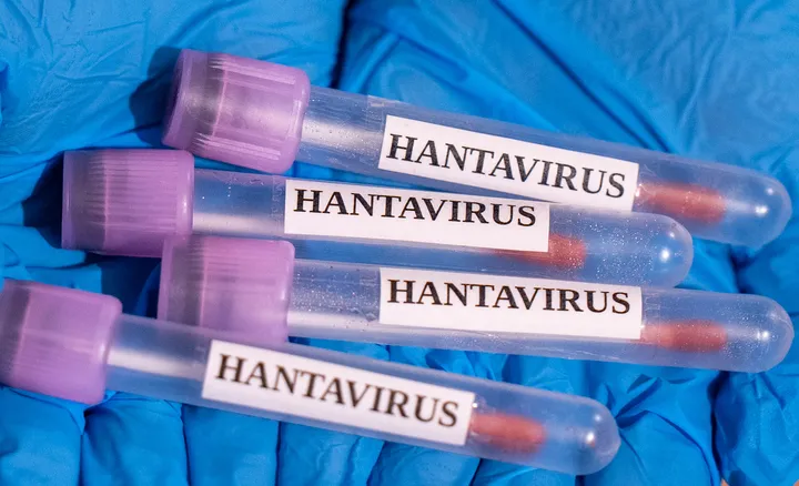 US citizen onboard hantavirus-hit cruise ship tests positive