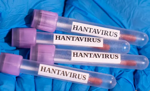 US citizen onboard hantavirus-hit cruise ship tests positive