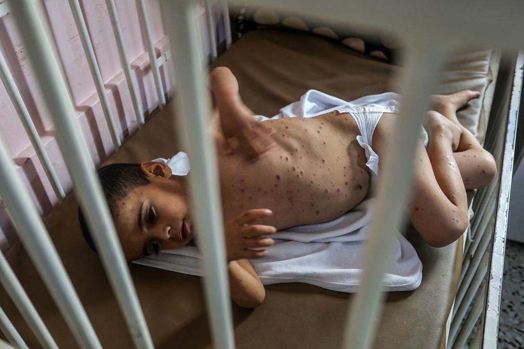 UN warns Israel's Gaza occupation plan will deepen child suffering