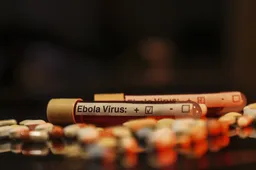 ئېبولا ۋىرۇسى قەيەرگە يوشۇرۇنۇۋالدى؟ تەتقىقاتچىلار يىللاردىن بۇيان ئۇنىڭ مەنبەسىنى ئىزدىمەكتە