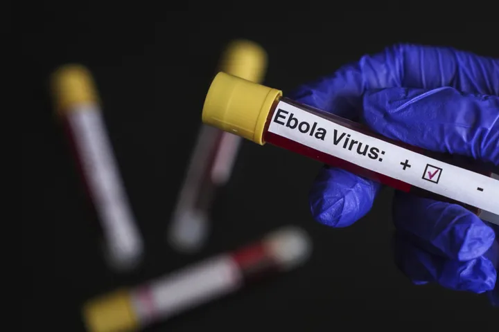 RDC : plus de 7 500 cas d’Ebola recensés, la riposte se poursuit dans sept provinces