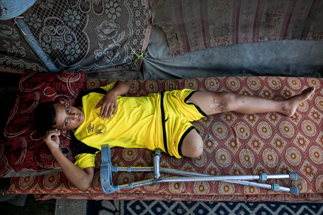 Uma campanha, duas realidades: Adidas destaca ex-soldado israelita enquanto amputados de Gaza sofrem