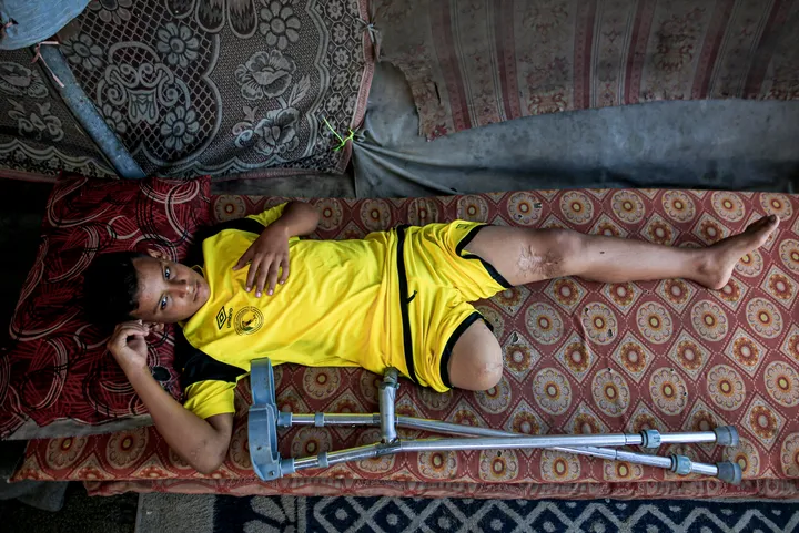 Uma campanha, duas realidades: Adidas destaca ex-soldado israelita enquanto amputados de Gaza sofrem