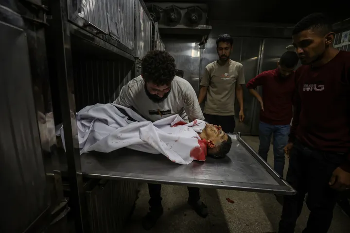 Israel kills 7 besieged Palestinians, wounds a dozen in attacks across Gaza