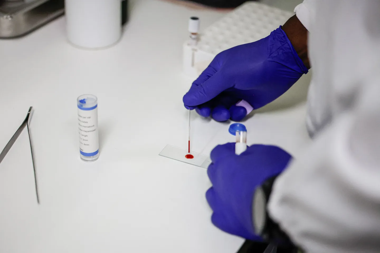 11.2 million Nigerians dey battle diabetes as stakeholders dey find ways to cut sugar