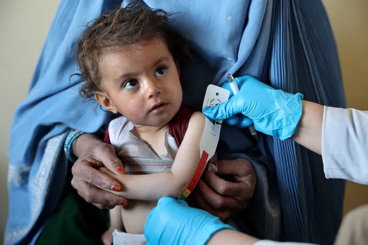 UNICEF: Egy millió gyermek halhat meg Afganisztánban a súlyos akut alultápláltság miatt