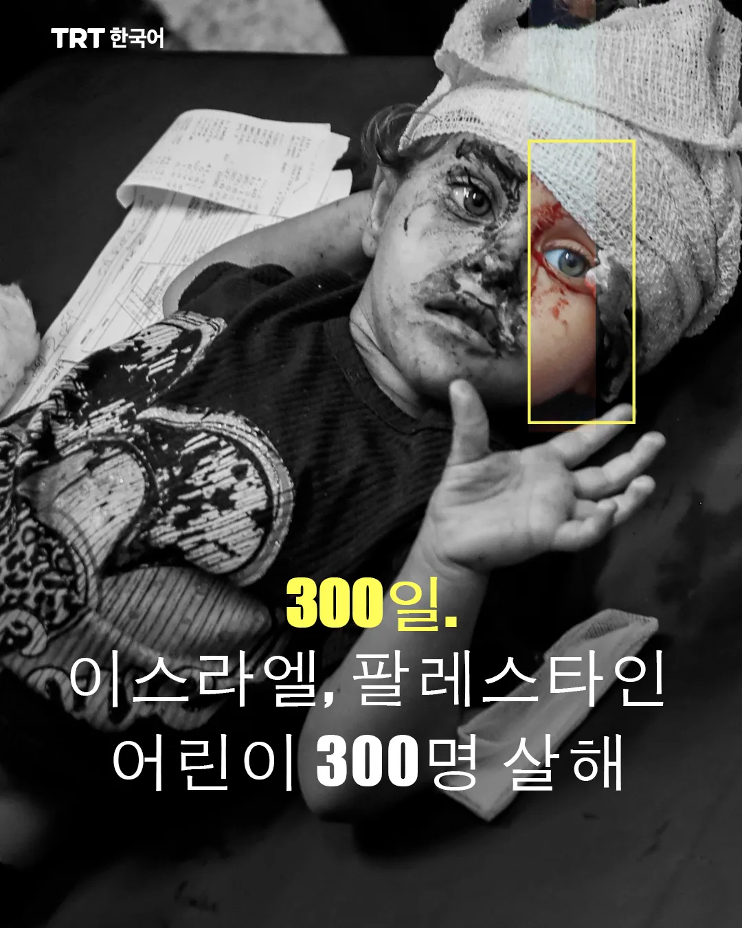 300일. 이스라엘, 팔레스타인 어린이 300명 살해
