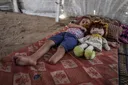 Каждый четвертый раненый палестинец получил необратимые травмы – ООН