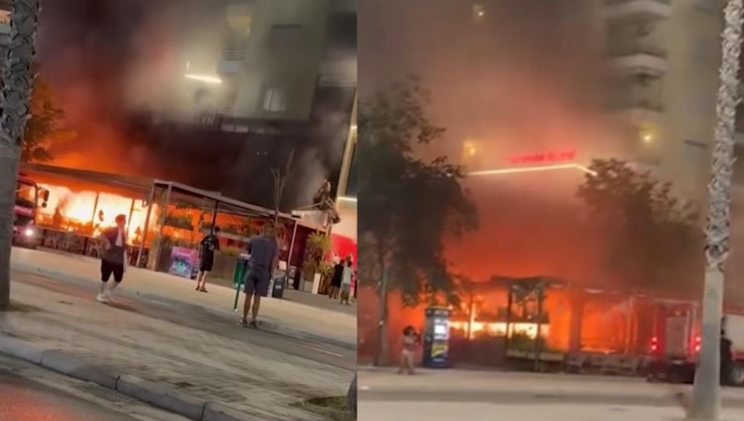 Shqipëri  e lënduara nga zjarri në një hotel në Vlorë dërgohet në Türkiye për trajtim