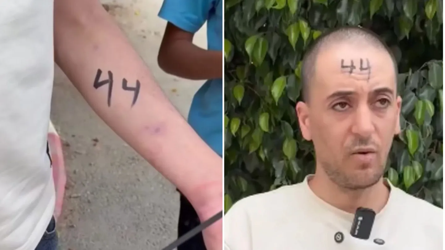 جيش الاحتلال يعترف بوضع أرقام على أجساد الأسرى الفلسطينيين في الضفة