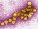 Mehr als 1.000 Fälle von West-Nil-Virus in Europa
