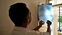 Nigeria's Plateau State records 11,000 tuberculosis cases in 2026