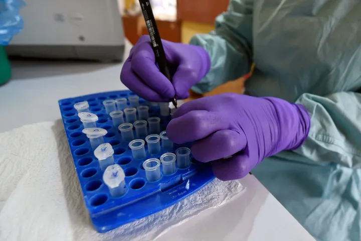 Ebola: Nigeria plan state treatment centres as contacts reach 53