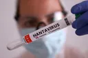 L'OMS met en garde contre une augmentation probable des cas d'hantavirus