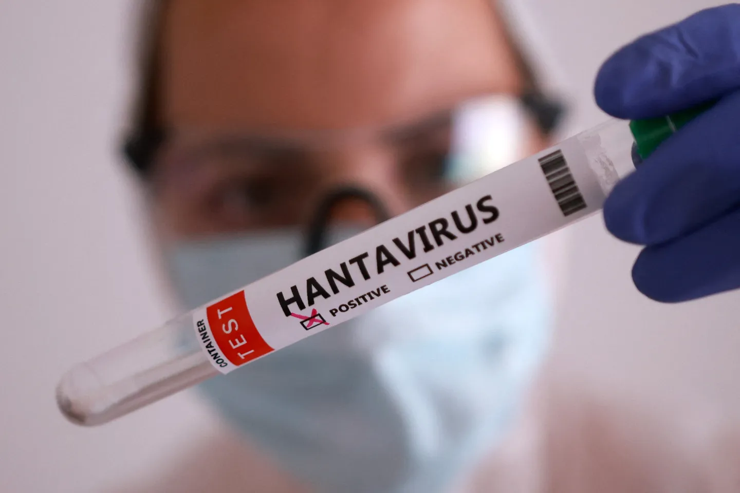 L'OMS met en garde contre une augmentation probable des cas d'hantavirus