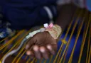 Cholera outbreak in West Kordofan killed 23 and infected 310, Sudanese group says